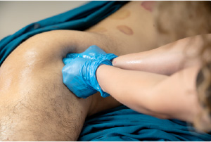 Treatment
